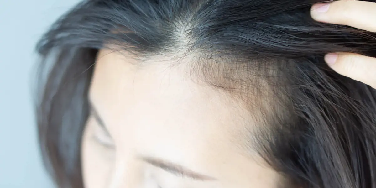 4 ways to improve scalp health
