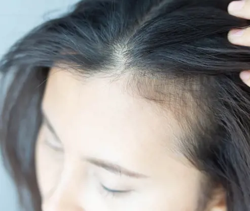 Ways to improve scalp health